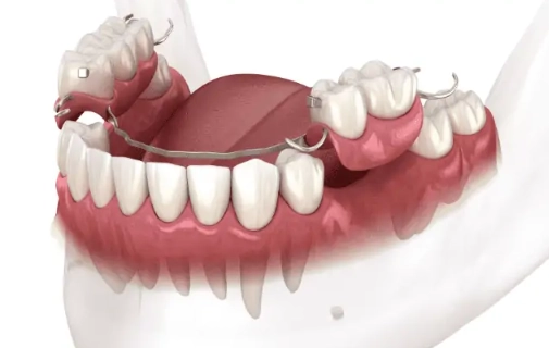 how much are dentures