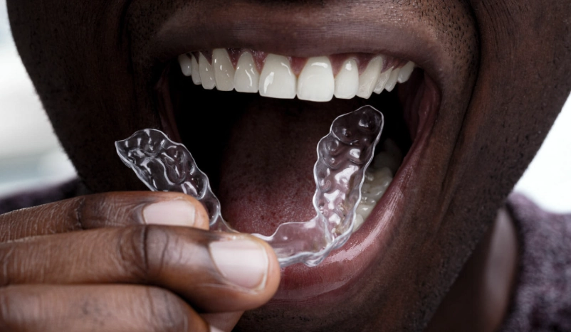 best night guard for teeth grinding