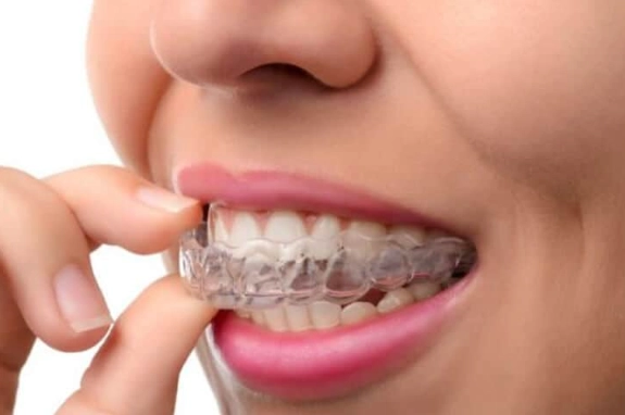 sleep apnea mouth guard