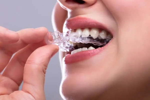 bruxism guard side effects bruxism guard side effects