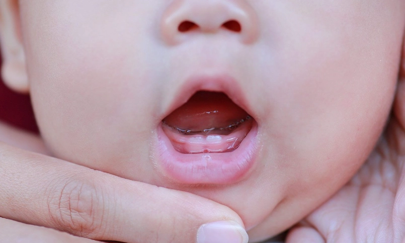 baby teething pain symptoms baby teething pain symptoms