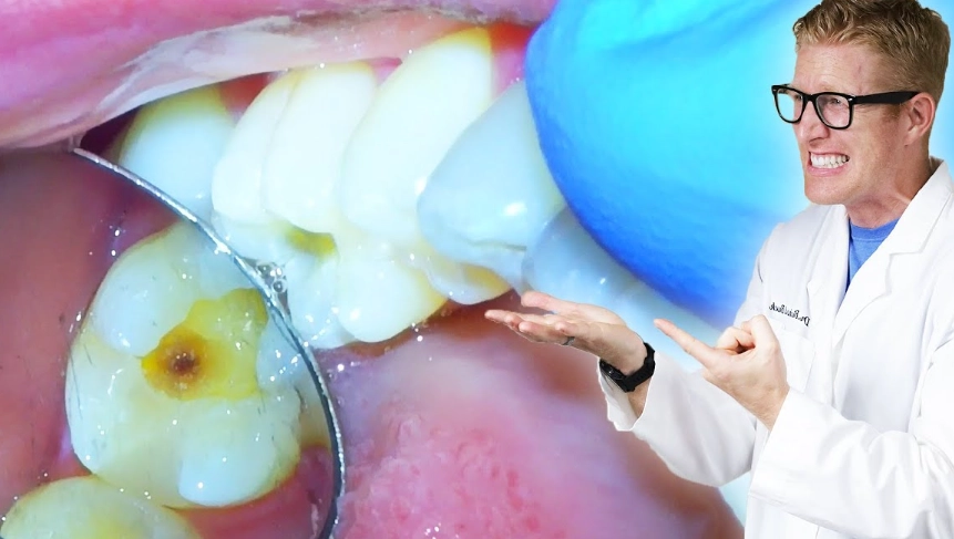 tooth filling pain weeks later