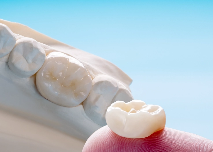 cost to scale a business