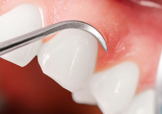 scaling and root planing cost scaling and root planing cost