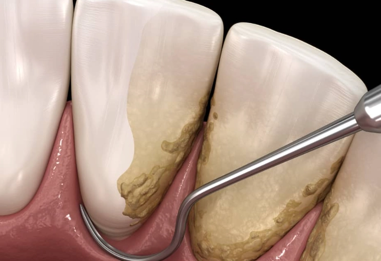 scaling operations pricing