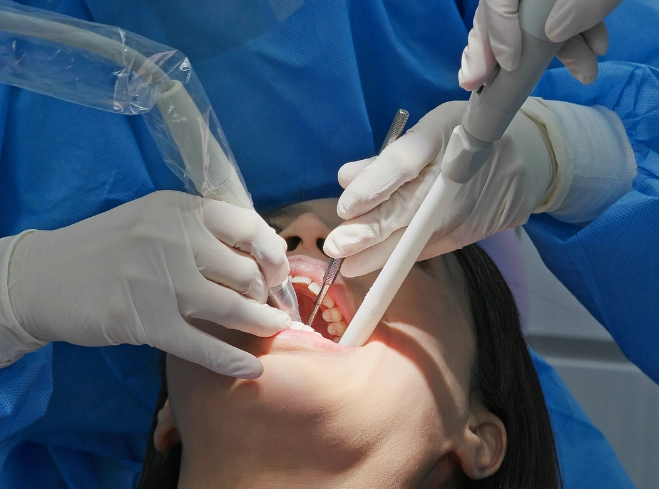 best sensitive teeth whitening strips