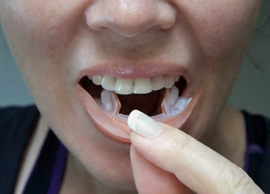 safest teeth whitening strips