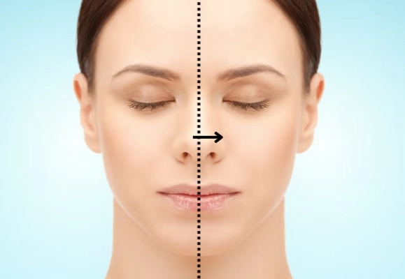 facial structure after wisdom teeth extraction