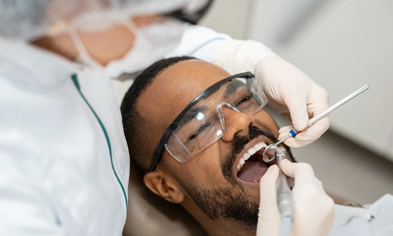 wisdom teeth removal effects on face