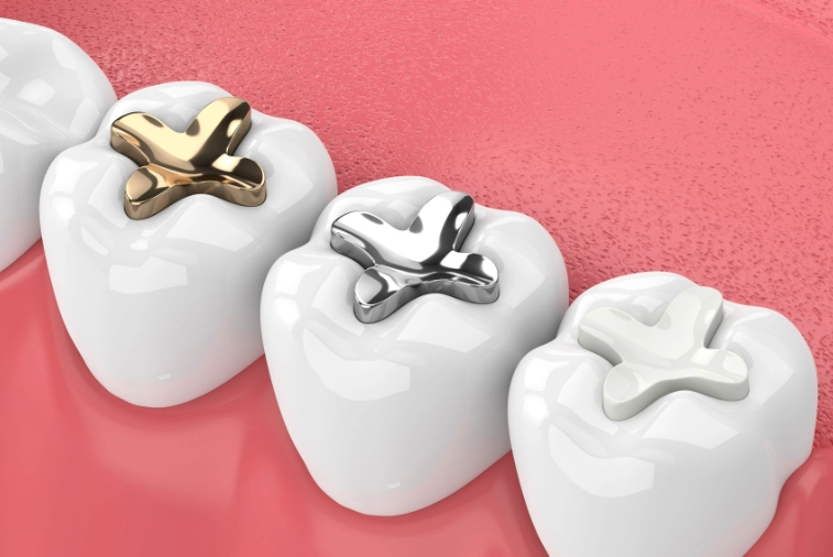 tooth filling procedure