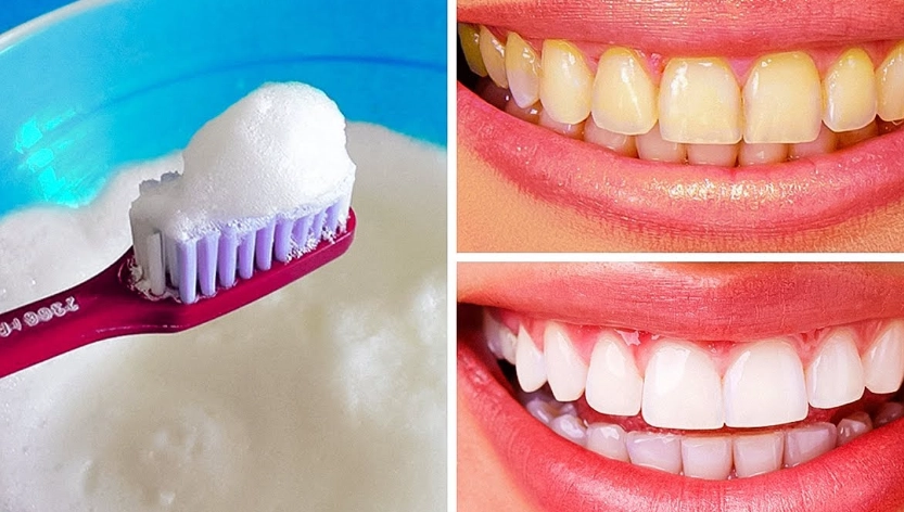 teeth whitening foods