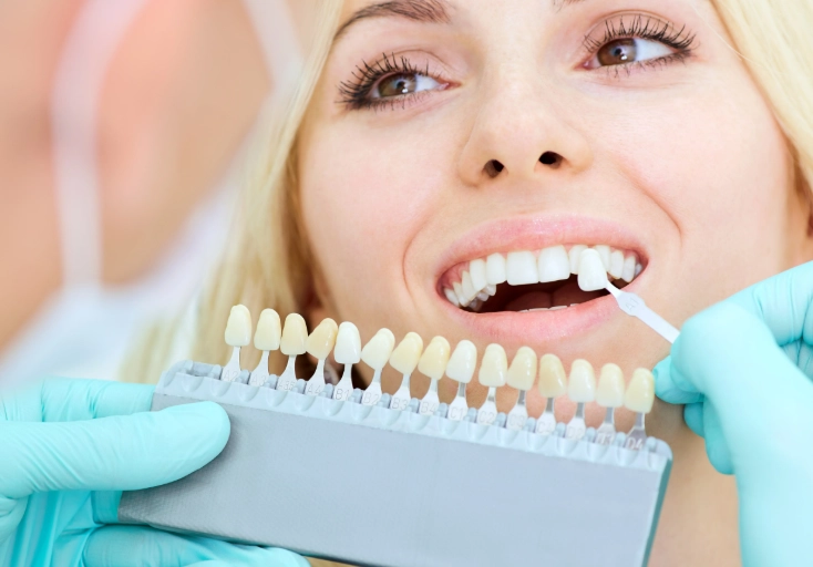 teeth whitening foods