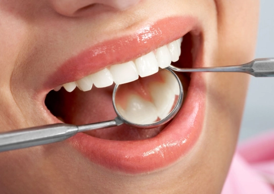 types of dental fillings