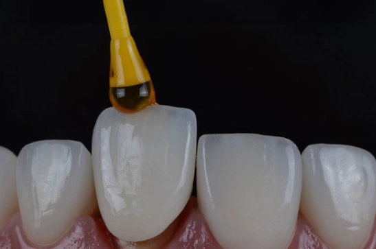 how to glue a crown back on