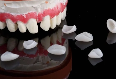 dental cement failure