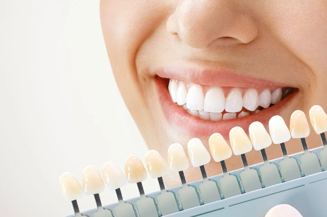 safest teeth whitening
