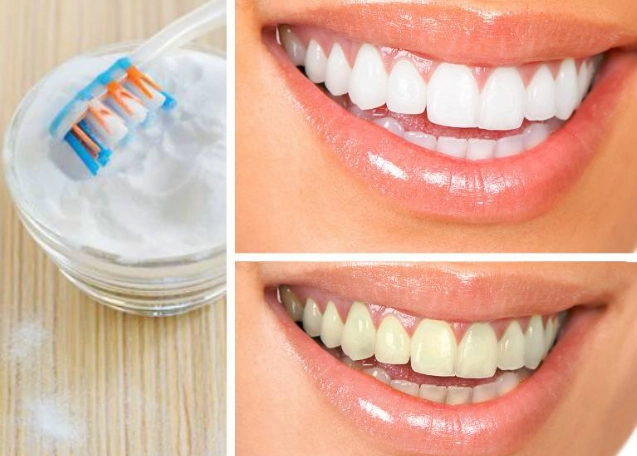 natural teeth whitening