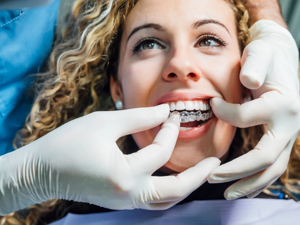 teeth shift without retainer