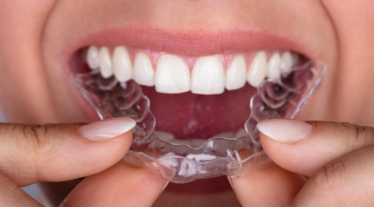 how long do retainers last