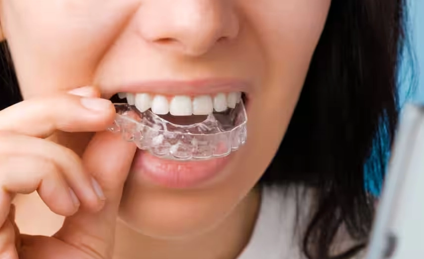 how often replace retainer