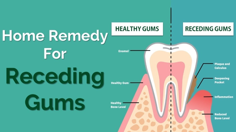 gum recession treatment