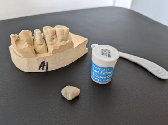 permanent dental adhesive