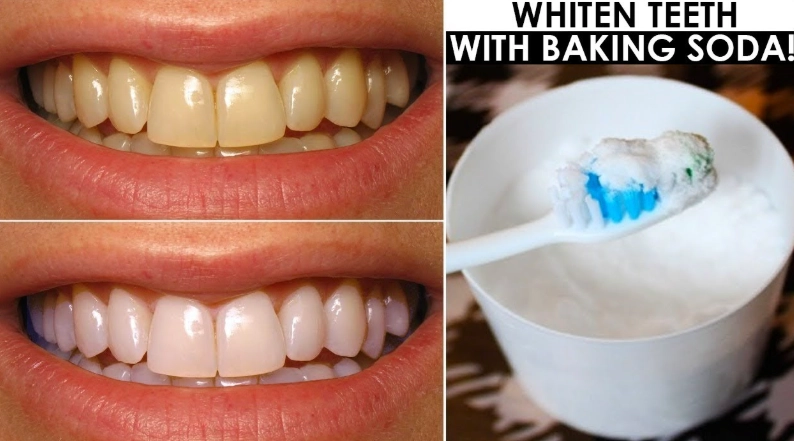 whiten teeth in 5 minutes whiten teeth in 5 minutes