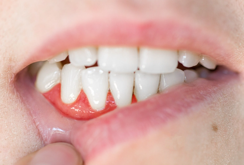 dental abscess treatment