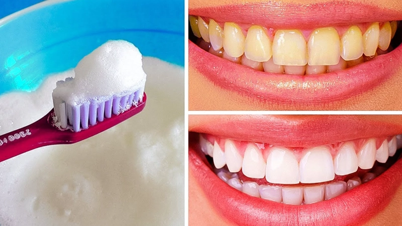 quick teeth whitening quick teeth whitening