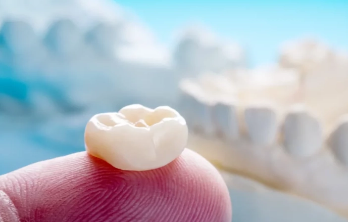 tooth crown glue