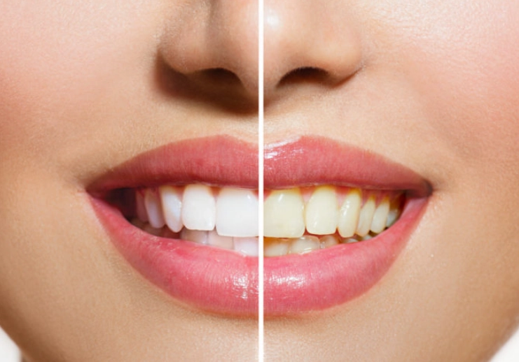 citric acid dental health