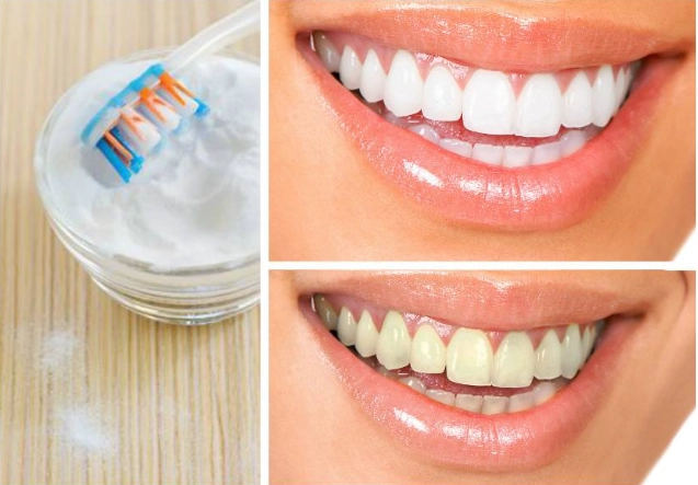 quick teeth whitening quick teeth whitening