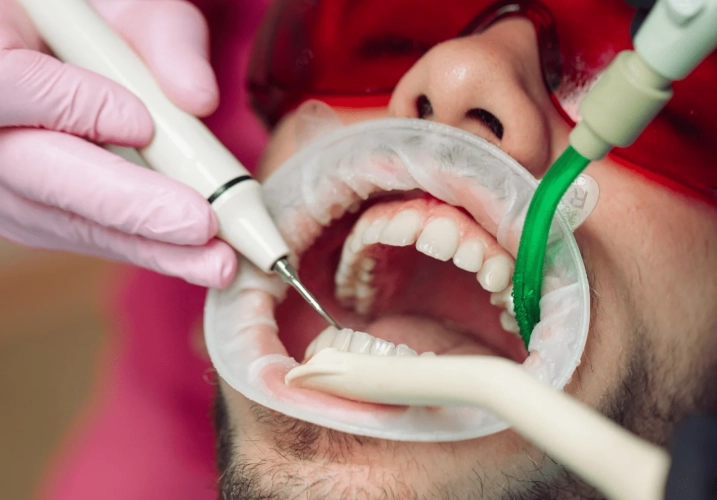 professional cleaning cons professional cleaning cons