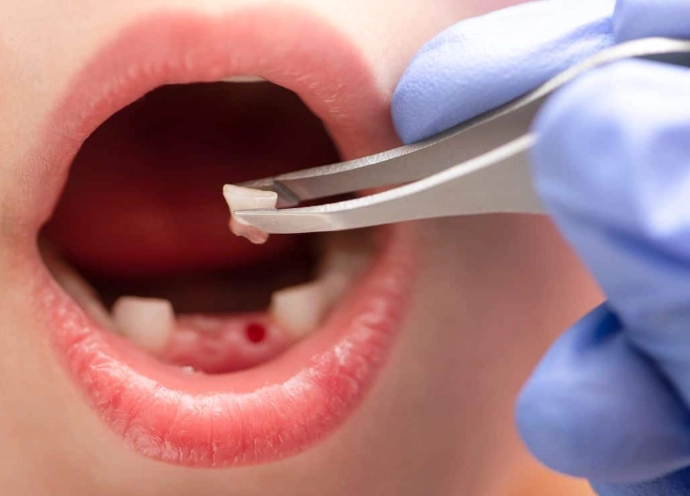 instant tooth nerve pain relief instant tooth nerve pain relief