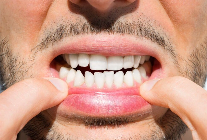 worst foods for teeth worst foods for teeth