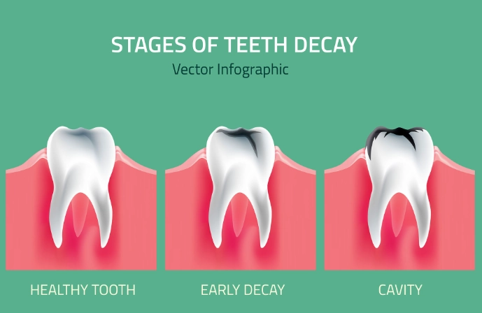 cavity pain symptoms