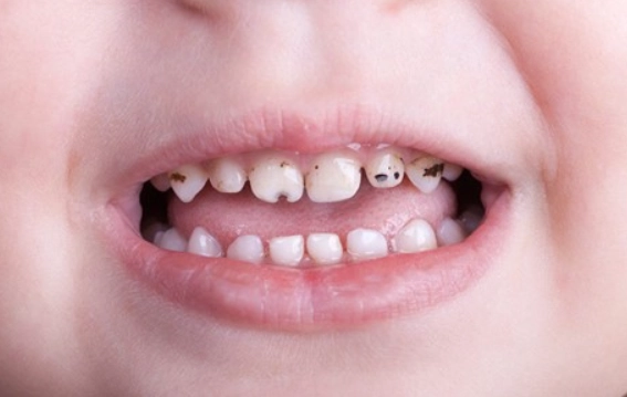 how to prevent bottle rot