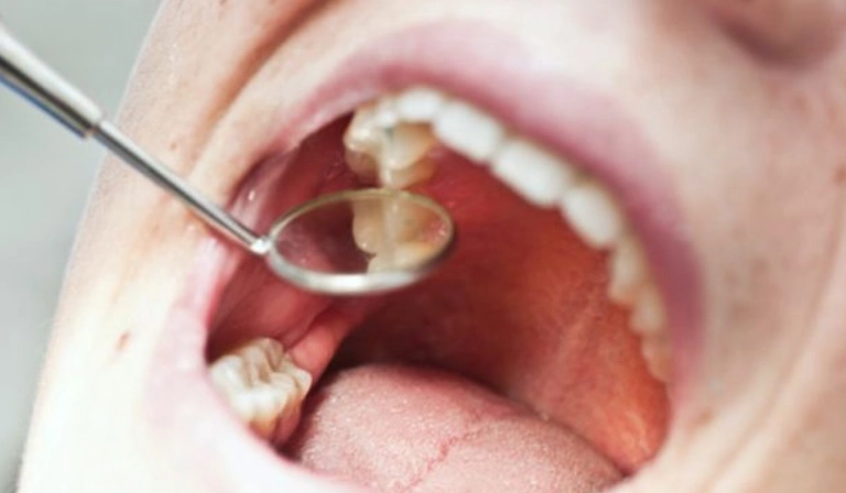 does a filling hurt does a filling hurt