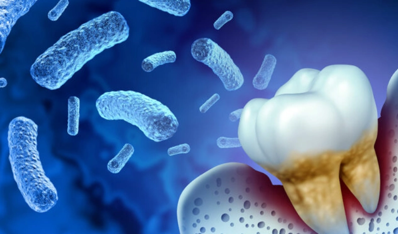 how to treat P. gingivalis how to treat P. gingivalis