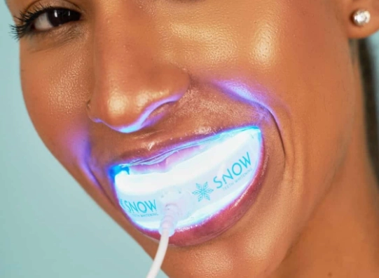 best teeth whitening