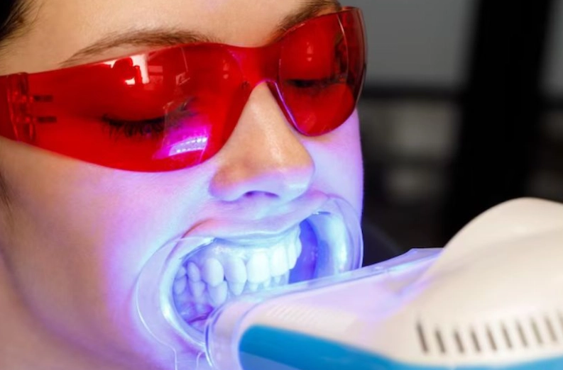 teeth whitening products reviews