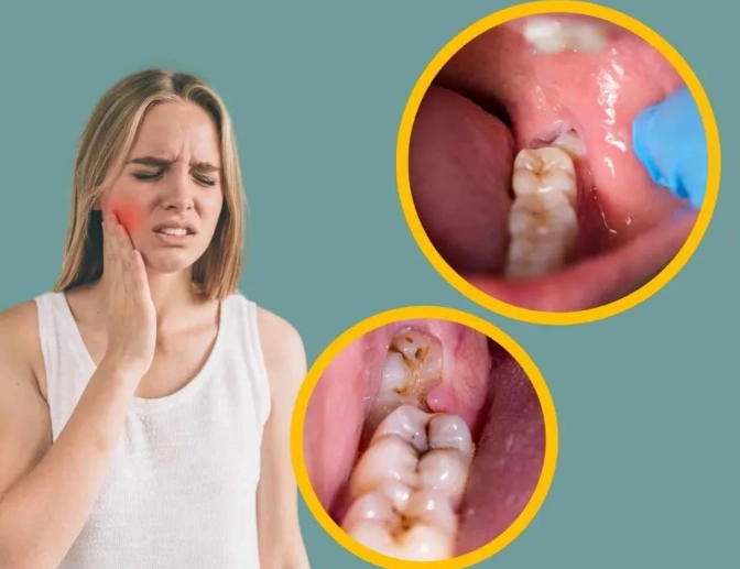 toothache relief toothache relief