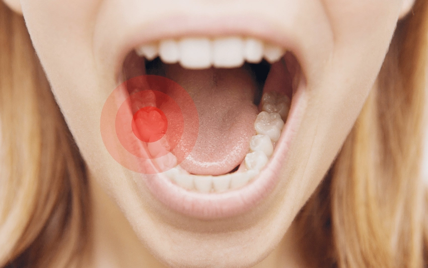 salt water rinse for toothache salt water rinse for toothache