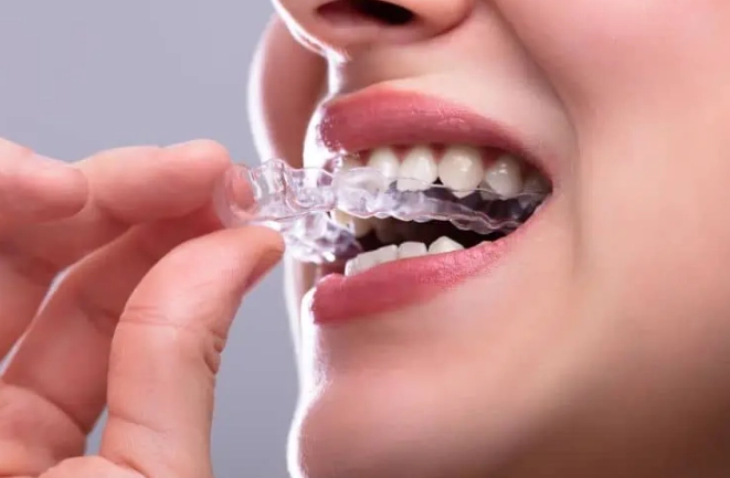 soft night guard for teeth grinding