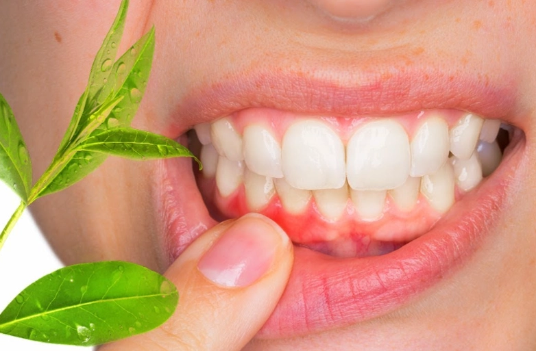 pediatric gum disease