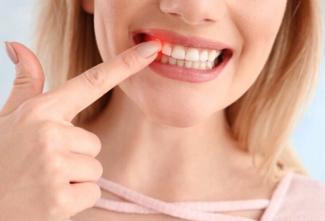 gum recession treatment kids