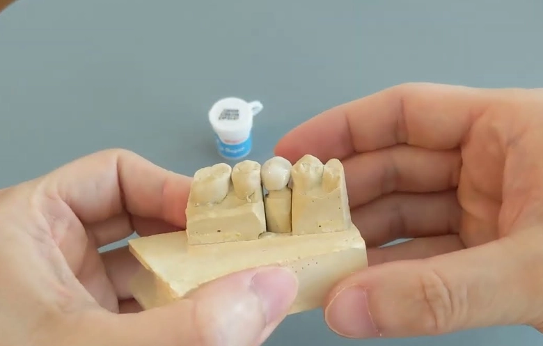 dental crown glue price