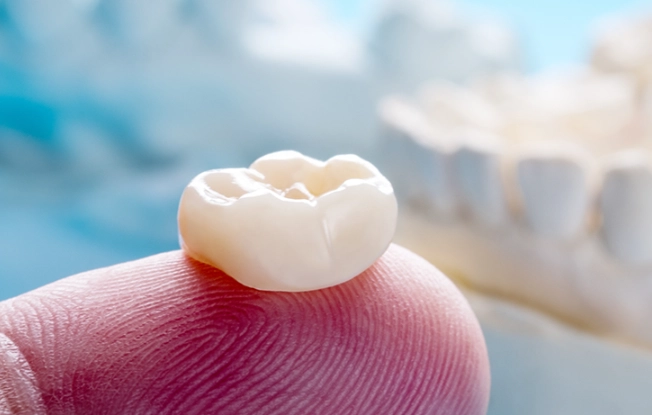 crown recementation cost