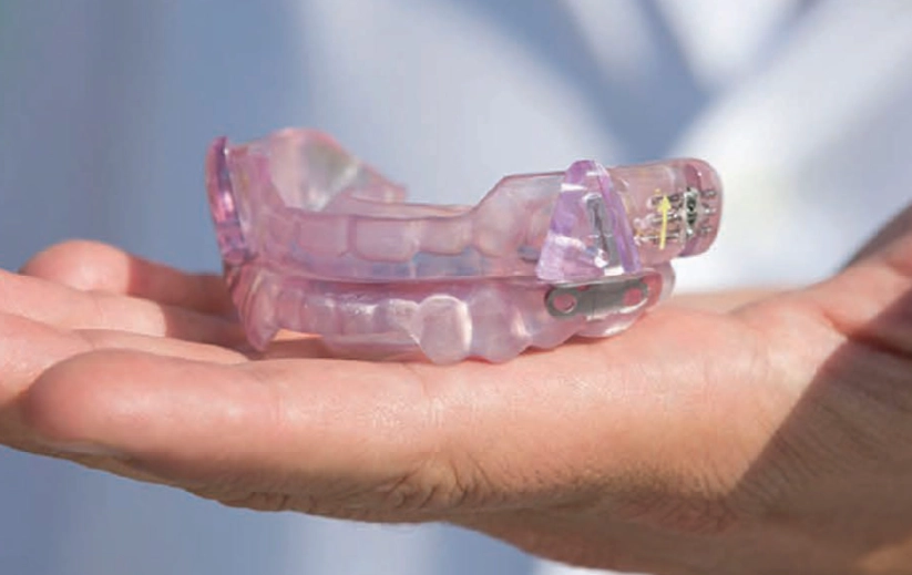 mandibular advancement device