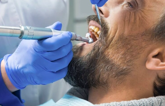 dental deep cleaning reviews